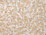 DHRSX Polyclonal Antibody