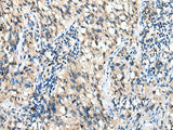 DHRSX Polyclonal Antibody