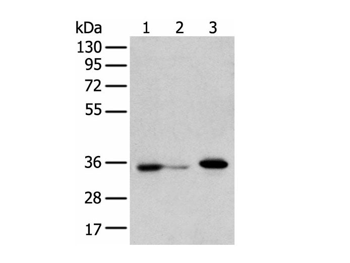 DHRSX Polyclonal Antibody