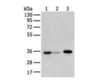 DHRSX Polyclonal Antibody