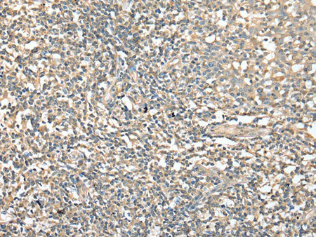 CD1D Polyclonal Antibody