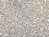 CD1D Polyclonal Antibody