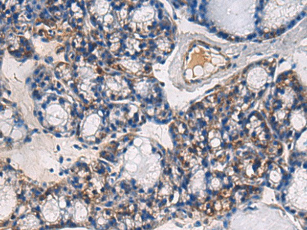 ABHD14B Polyclonal Antibody Reactivity Human