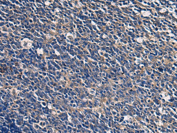 ABHD14B Polyclonal Antibody Reactivity Human