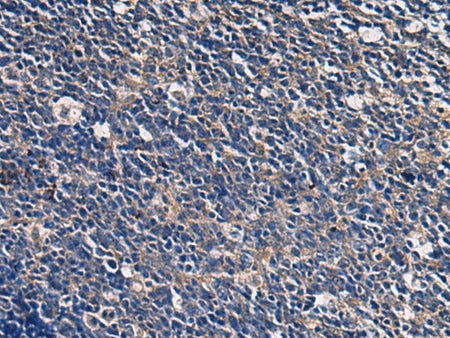 ABHD14B Polyclonal Antibody Reactivity Human