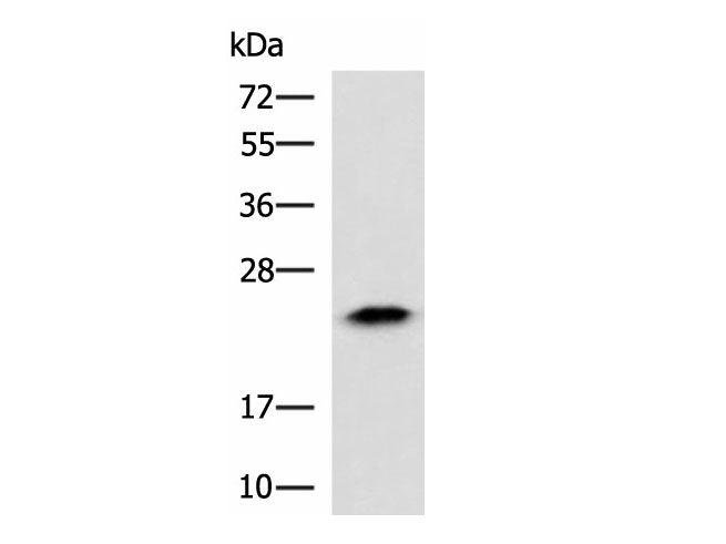 ABHD14B Polyclonal Antibody Reactivity Human