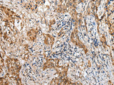 LYPD4 Polyclonal Antibody