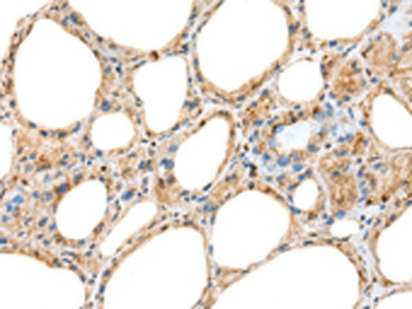 RAB11A Polyclonal Antibody Reactivity Human