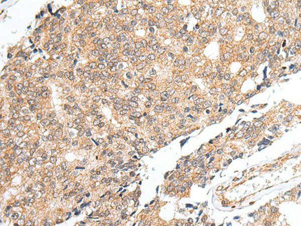 PRELID1 Polyclonal Antibody