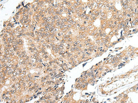 PRELID1 Polyclonal Antibody