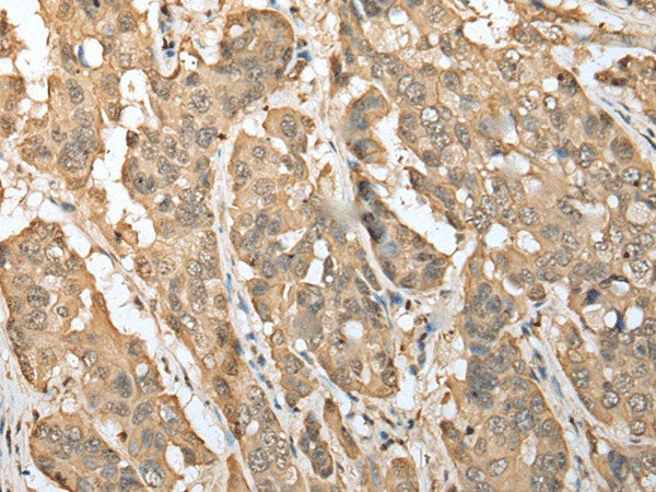 ZNF672 Polyclonal Antibody