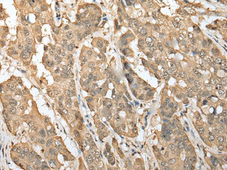 ZNF672 Polyclonal Antibody