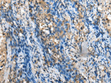 MOB4 Polyclonal Antibody Reactivity Human