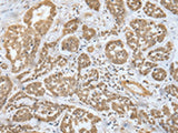 MOB4 Polyclonal Antibody Reactivity Human
