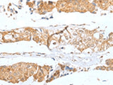 GLIPR1L1 Polyclonal Antibody