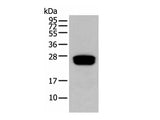 GLIPR1L1 Polyclonal Antibody