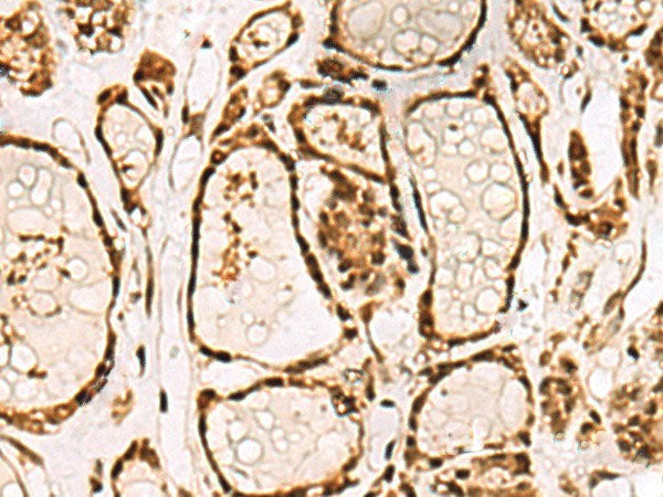LRRC2 Polyclonal Antibody Reactivity Human