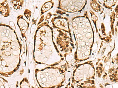LRRC2 Polyclonal Antibody Reactivity Human