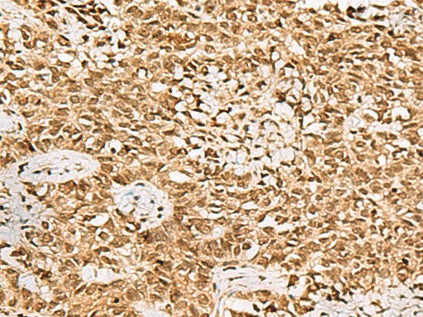 LRRC2 Polyclonal Antibody Reactivity Human