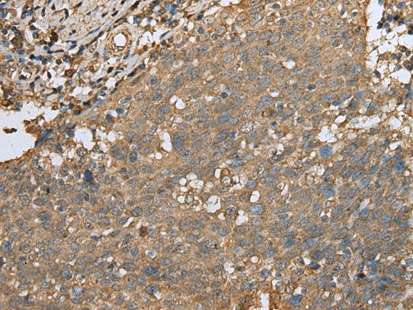 ALKBH8 Polyclonal Antibody