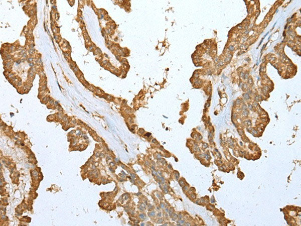 ALKBH8 Polyclonal Antibody