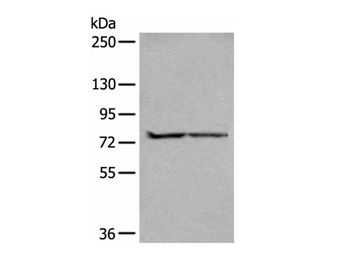 ALKBH8 Polyclonal Antibody