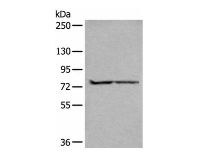 ALKBH8 Polyclonal Antibody
