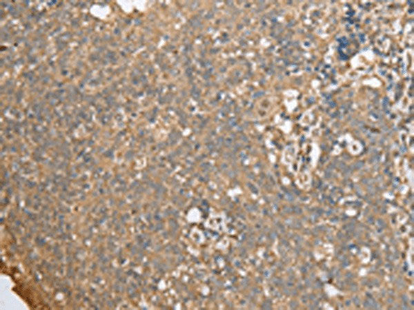 ECI1 Polyclonal Antibody Reactivity Human