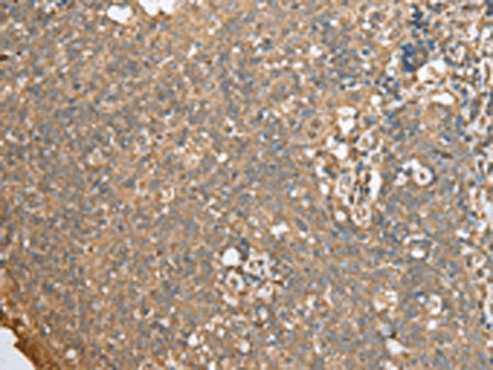 ECI1 Polyclonal Antibody Reactivity Human