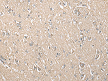ECI1 Polyclonal Antibody Reactivity Human