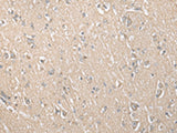 ECI1 Polyclonal Antibody Reactivity Human