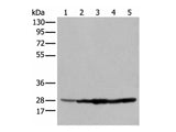 ECI1 Polyclonal Antibody Reactivity Human