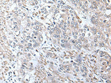 METTL7A Polyclonal Antibody Reactivity Human