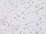 METTL7A Polyclonal Antibody Reactivity Human