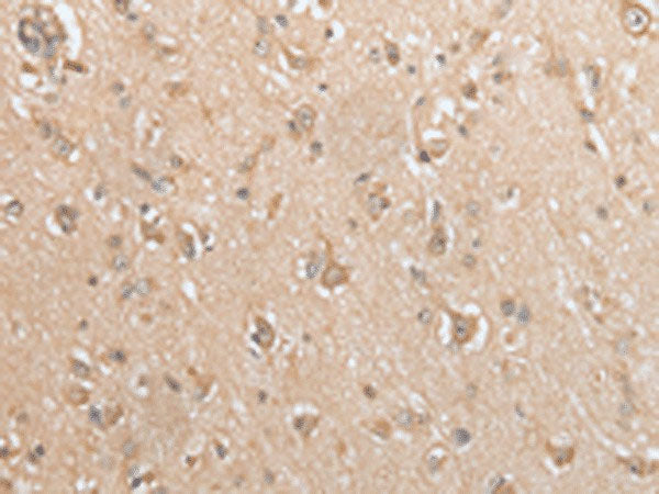 GCLC Polyclonal Antibody
