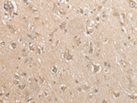 GCLC Polyclonal Antibody