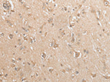 GCLC Polyclonal Antibody