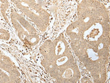 HDHD2 Polyclonal Antibody