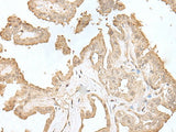 HDHD2 Polyclonal Antibody