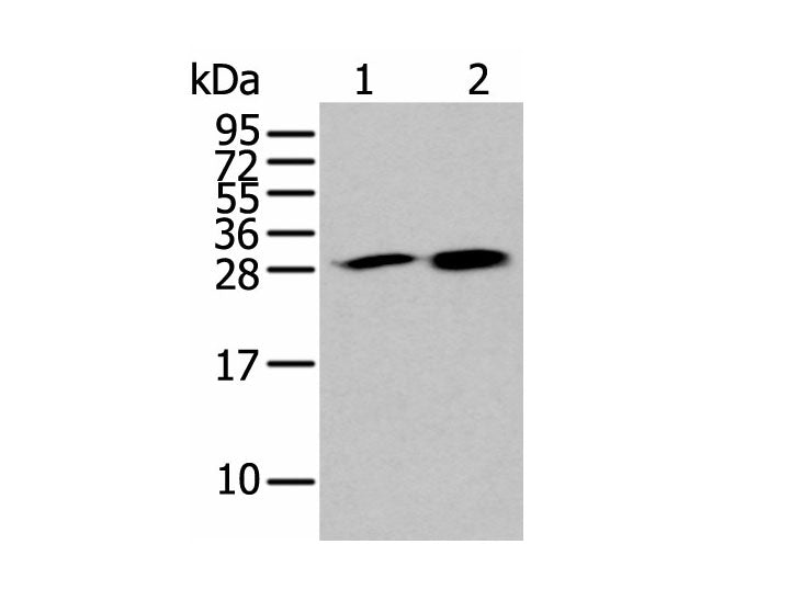 HDHD2 Polyclonal Antibody