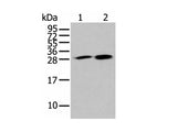 HDHD2 Polyclonal Antibody