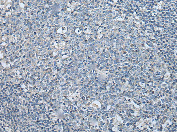 LASP1 Polyclonal Antibody Reactivity Human