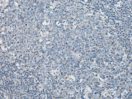 LASP1 Polyclonal Antibody Reactivity Human