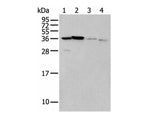 LASP1 Polyclonal Antibody Reactivity Human
