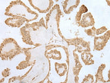 ZNF281 Polyclonal Antibody Reactivity Mouse