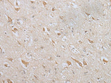 ZNF281 Polyclonal Antibody Reactivity Mouse