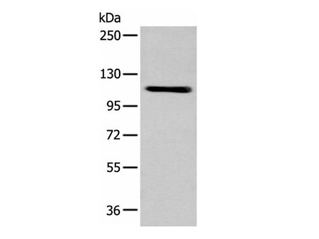 ZNF281 Polyclonal Antibody Reactivity Mouse
