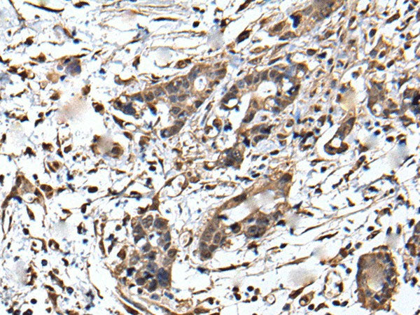 ZFP36 Polyclonal Antibody Reactivity Human