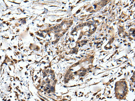 ZFP36 Polyclonal Antibody Reactivity Human
