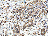 ZFP36 Polyclonal Antibody Reactivity Human